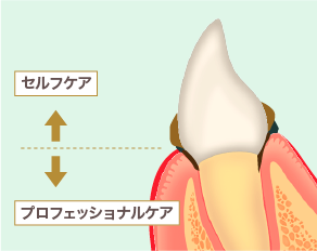 お口の健康を保つには？